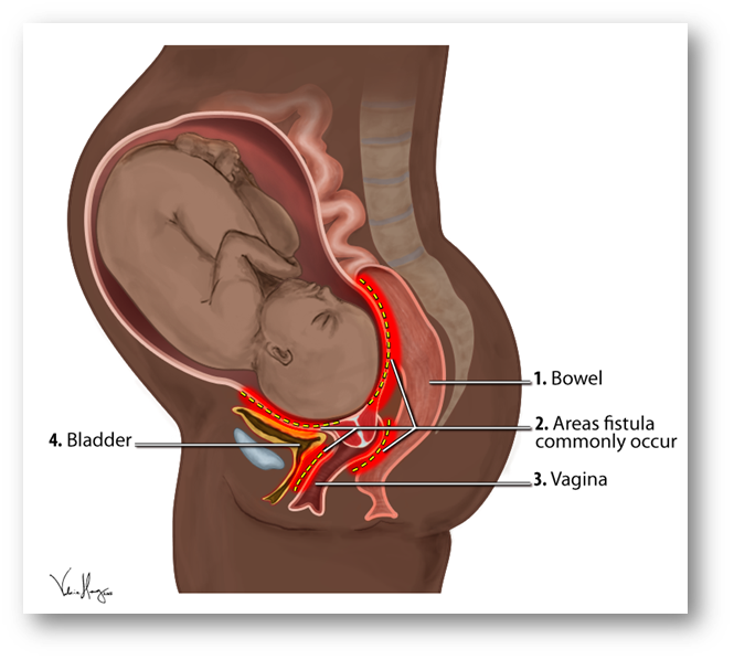 Areas of obstetric